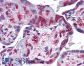 Anti-YBX1 / YB1 Antibody (aa143-192) IHC-plus LS-B5607