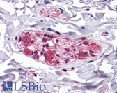 Anti-KLHL3 Antibody (aa71-120) IHC-plus LS-B5609
