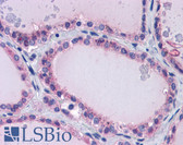 Anti-PAX8 Antibody (aa215-264) IHC-plus LS-B5611