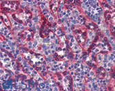 Anti-TBX18 Antibody (aa421-470) IHC-plus LS-B5621