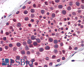 Anti-TDRD9 / HIG-1 Antibody (aa1071-1120) IHC-plus LS-B5623