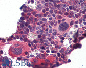 Anti-KLF2 Antibody (N-Terminus) IHC-plus LS-B5627