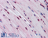 Anti-TTF1 / Txn Termination Factor Antibody (aa51-100) IHC-plus LS-B5631