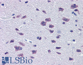 Anti-DMBX1 / OTX3 Antibody (aa176-225) IHC-plus LS-B5635