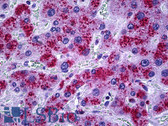 Anti-CAT / Catalase Antibody (aa361-410) IHC-plus LS-B5636