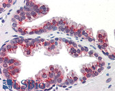Anti-KLF4 Antibody (aa401-450) IHC-plus LS-B5641
