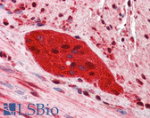 Anti-ZEB2 Antibody (C-Terminus) IHC-plus LS-B5644