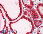 Anti-TRIM33 / TIF1-Gamma Antibody (C-Terminus) IHC-plus LS-B5645