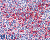 Anti-PBRM1 / BAF180 / PB1 Antibody (aa1511-1560) IHC-plus LS-B5646