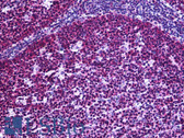 Anti-IGF2R / CD222 Antibody (aa2441-2490) IHC-plus LS-B5653