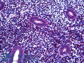Anti-FANCA Antibody (aa1121-1170) IHC-plus LS-B5656