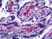 Anti-MMP11 Antibody (aa61-110) IHC-plus LS-B5662