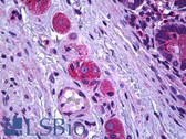 Anti-SSBP2 Antibody (aa10-59) IHC-plus LS-B5667