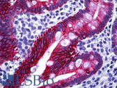 Anti-KRT20 / CK20 / Cytokeratin 20 Antibody (aa375-424) IHC-plus LS-B5677