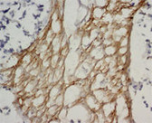 MMP2 IHC Antibody