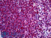 Anti-NCF1 / p47phox / p47 phox Antibody (aa341-390) IHC-plus LS-B5698