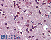 Anti-SRSF3 / SRP20 Antibody (aa38-87) IHC-plus LS-B5703