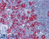 Anti-PRKRA / PACT Antibody (N-Terminus) IHC-plus LS-B5704