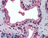 Anti-PABPN1 / PABP2 Antibody (N-Terminus) IHC-plus LS-B5706