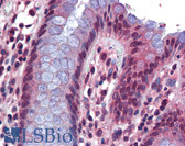 Anti-SRSF4 / SFRS4 Antibody (aa359-408) IHC-plus LS-B5709