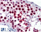 Anti-KHDRBS1 / SAM68 Antibody (aa359-408) IHC-plus LS-B5713
