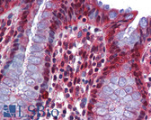 Anti-RBM47 Antibody (aa287-336) IHC-plus LS-B5717