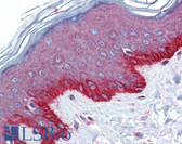 Anti-FZD4 / Frizzled 4 Antibody (C-Terminus) IHC-plus LS-B5723