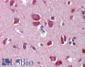Anti-WNT7B Antibody (aa215-264) IHC-plus LS-B5725