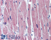 Anti-TNNI3 / CTnI Antibody (C-Terminus) IHC-plus LS-B5726
