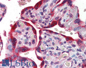 Anti-ABCB4 / MDR3 Antibody (aa252-301) IHC-plus LS-B5729