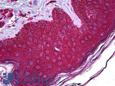 Anti-ABHD5 Antibody (clone 1F3) IHC-plus LS-B5751