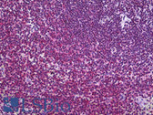 Anti-CFLAR / FLIP Antibody (clone 2F12) IHC-plus LS-B5753