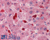 Anti-SLC8A3 / NCX3 Antibody (aa144-193) IHC-plus LS-B5775