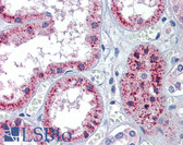 Anti-PTCH1 / Patched Antibody (aa58-107) IHC-plus LS-B5778