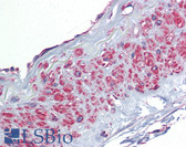 Anti-TGFBI Antibody (aa601-650) IHC-plus LS-B5780