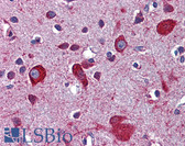 Anti-APOER2 / LRP8 Antibody (aa395-444) IHC-plus LS-B5784