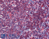 Anti-SC5D / ERG3 Antibody (aa71-120) IHC-plus LS-B5785