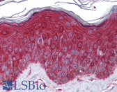 Anti-KREMEN1 / KREMEN-1 Antibody (aa71-120) IHC-plus LS-B5786