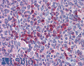 Anti-ROBO2 Antibody (aa252-301) IHC-plus LS-B5789