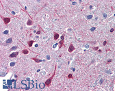 Anti-RARB / RAR Beta Antibody (C-Terminus) IHC-plus LS-B5790