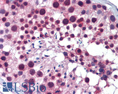 Anti-PLK1 / PLK-1 Antibody (C-Terminus) IHC-plus LS-B5792