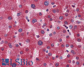 Anti-MTHFD1 Antibody (aa863-912) IHC-plus LS-B5794