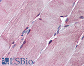 Anti-SGCE Antibody (aa36-85) IHC-plus LS-B5795