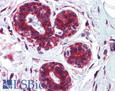 Anti-CKAP4 Antibody (aa216-265) IHC-plus LS-B5797