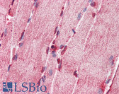 Anti-ACS5 / ACSL5 Antibody (aa470-519) IHC-plus LS-B5798