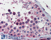 Anti-SMC3 / HCAP Antibody (aa1051-1100) IHC-plus LS-B5803