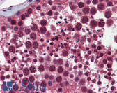 Anti-SELS Antibody (aa72-121) IHC-plus LS-B5808