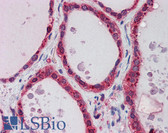 Anti-AKR1B1 / Aldose Reductase Antibody (N-Terminus) IHC-plus LS-B5811