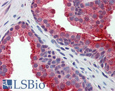 Anti-APH / APEH Antibody (aa144-193) IHC-plus LS-B5812