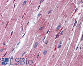 Anti-MLC2 / MYL9 Antibody (C-Terminus) IHC-plus LS-B5814